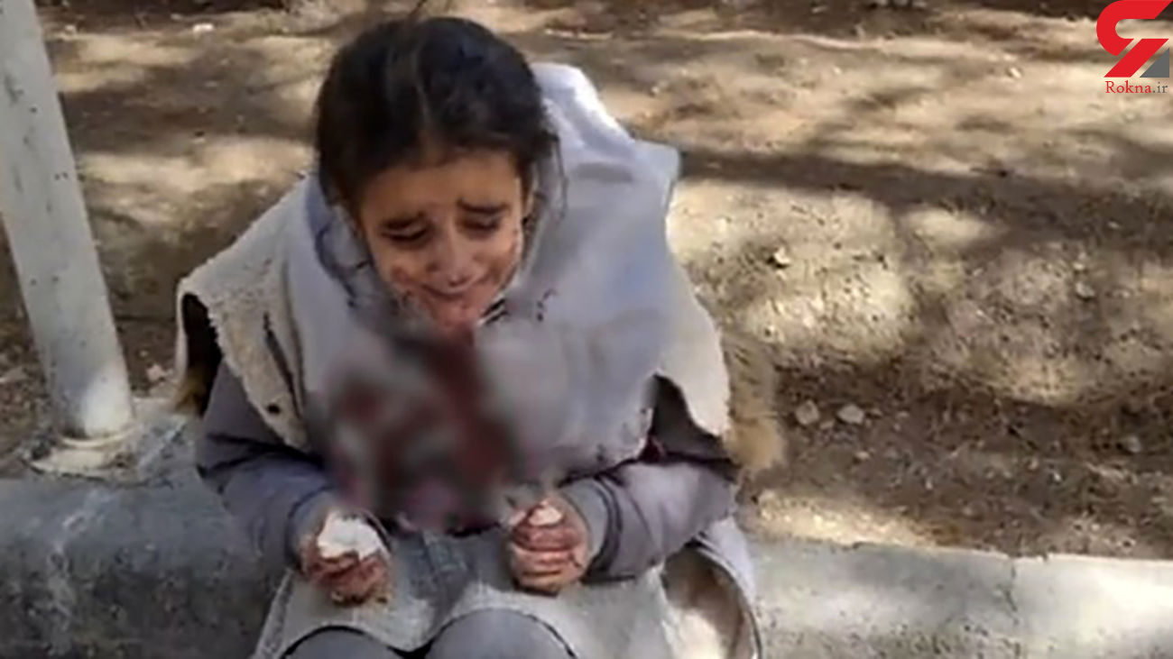 این دختر بچه چرا کتک خورد ؟/در اصفهان چه اتفاقی افتاده است؟ + عکس