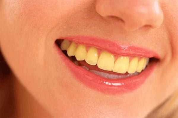 راه های برای سفید کردن دندان های زرد در منزل