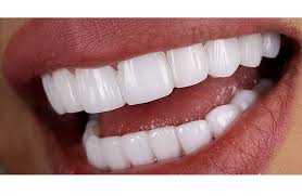 “راهکارهای جدید درمانی برای بهبود سلامت دندان‌ : آخرین دستاوردهای علمی”